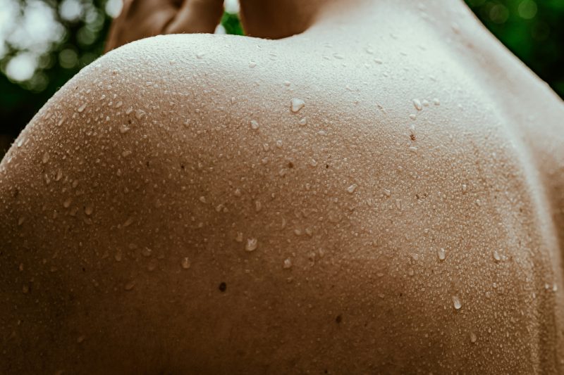 Woman experiencing night sweats with sweat beads on shoulder – Menopause symptoms